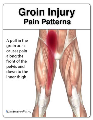 Groin pain patterns