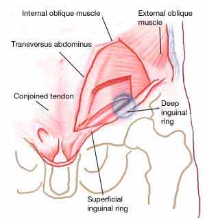 Sports Groin Injury location